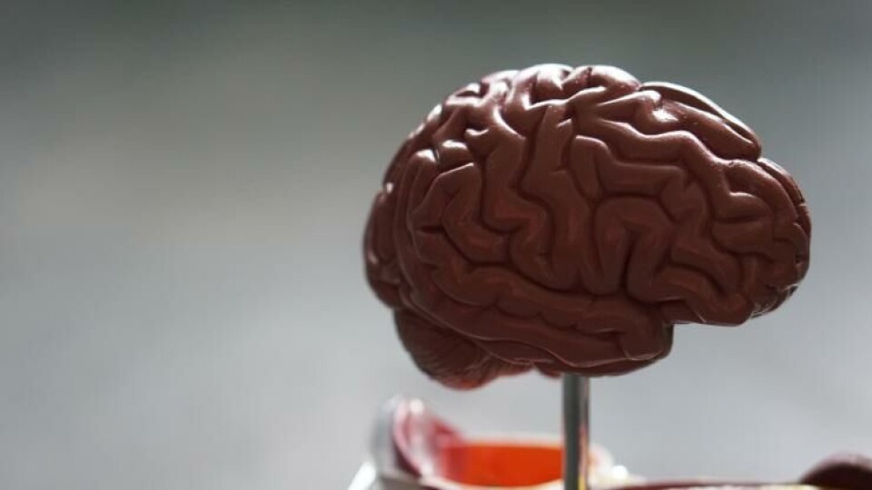 How does the brain work anyway?